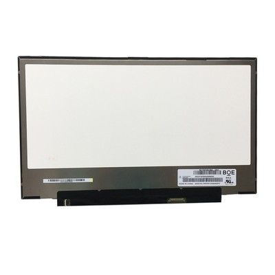 LB156WF1-SPA1 LG Display 15,6 de” EXHIBICIÓN INDUSTRIAL 19201080 400cd/m2 LCD